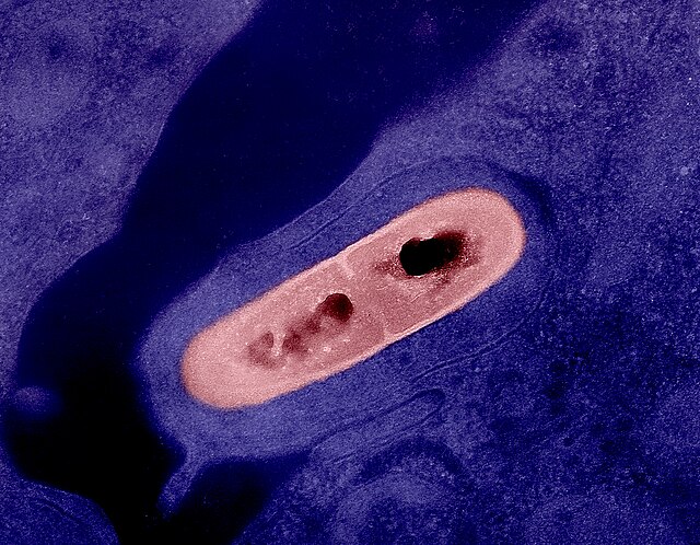 listeria_bacterium_02.jpg